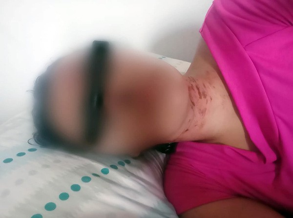 Mulher luta com criminoso e se finge de morta para evitar estupro próximo a viaduto em Hortolândia