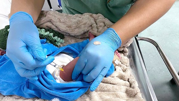 Americana inicia imunização contra VSR e amplia proteção a prematuros